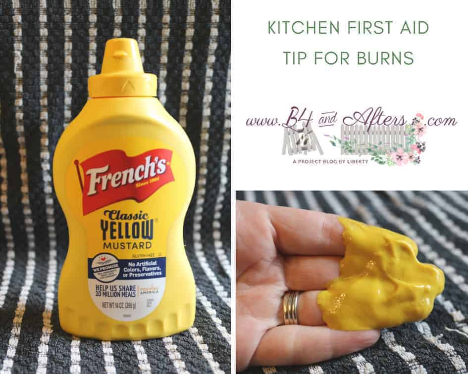 pinterest graphic for mustard burn first aid