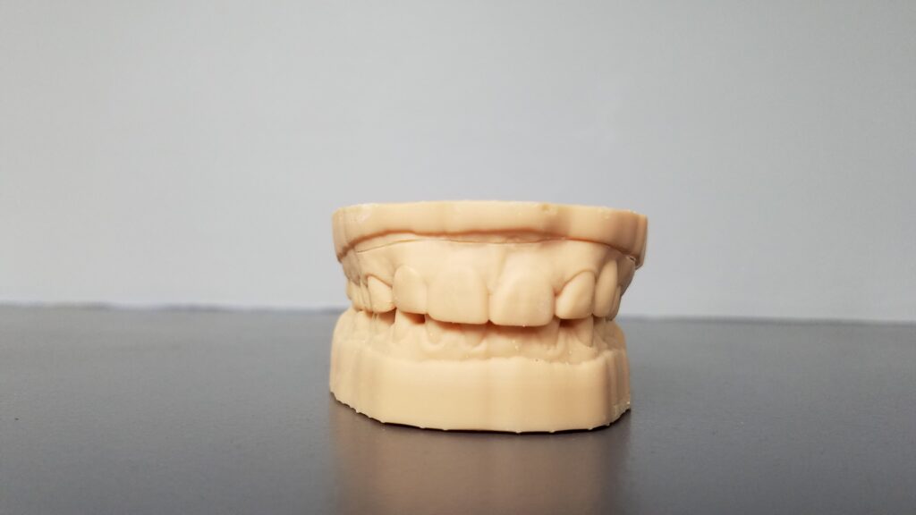model of teeth
