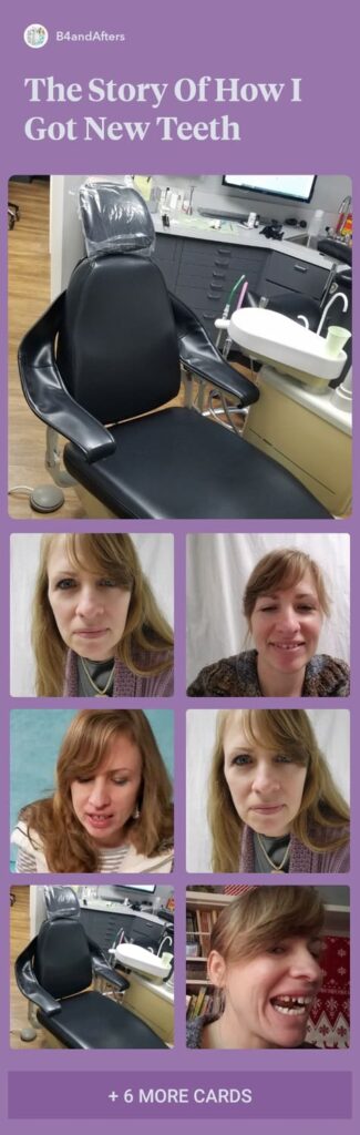 a dentist's chair with pictures of a girl with gaps in her teeth