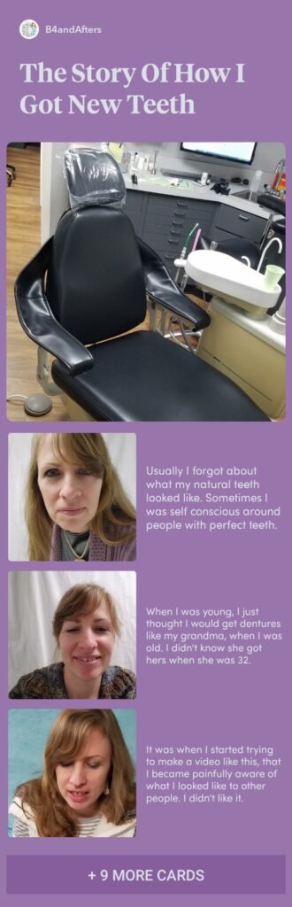 a collage of pictures in a story about getting new teeth